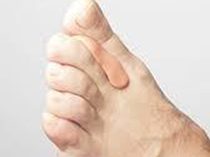 Orthopédie Mathis - podologue sur Chalon-sur-Saône