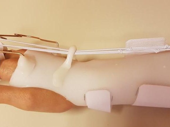 Orthopédie Mathis - podologue sur Chalon-sur-Saône