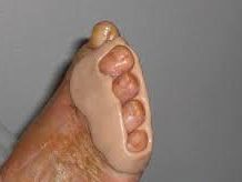 Orthopédie Mathis - podologue sur Chalon-sur-Saône