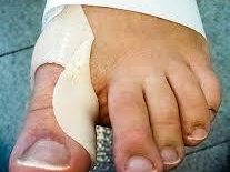 Orthopédie Mathis - podologue sur Chalon-sur-Saône