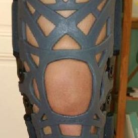 Orthopédie Mathis - podologue sur Chalon-sur-Saône